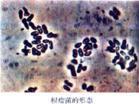 Nitrogenase