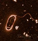 Legionella pneumophila