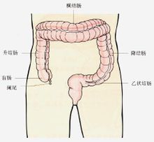 Ampio intestino