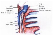 La resezione del cancro esofageo superiore