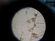 Angolo dinoflagellato