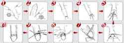 Balanoposthitis