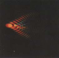 Coma