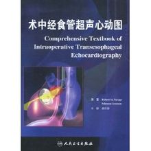 Ecocardiografia transesofagea intraoperatoria