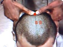 Baihui: Baihui
