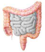 Il cancro del colon-retto